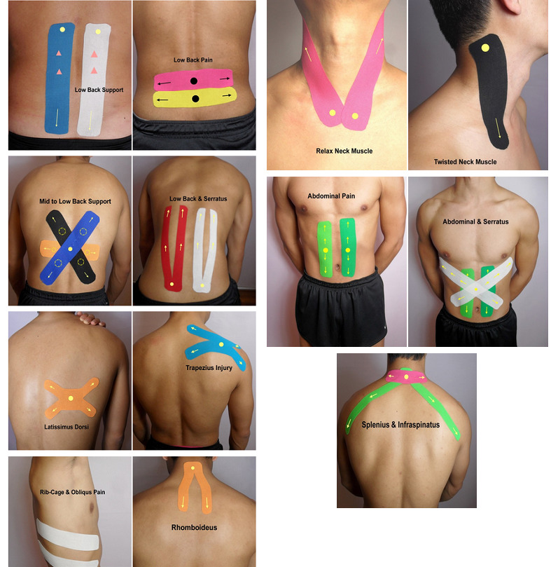 Kinesio tape. Спорт, реабилитация, косметология.