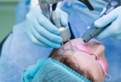 Tratament cu laser a acneei si sechelelor postacne
