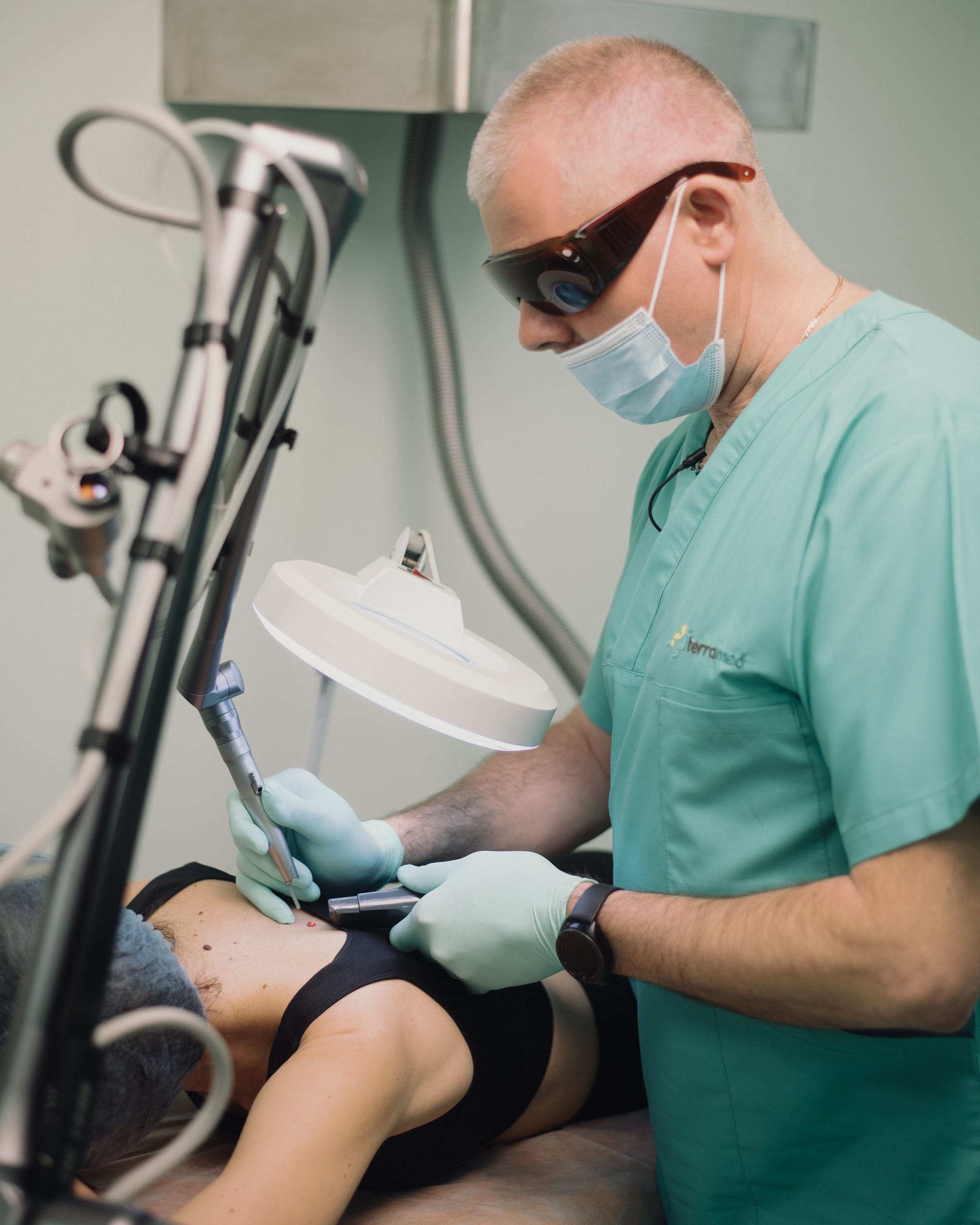  Лазерное удаление новообразований родинок невусов