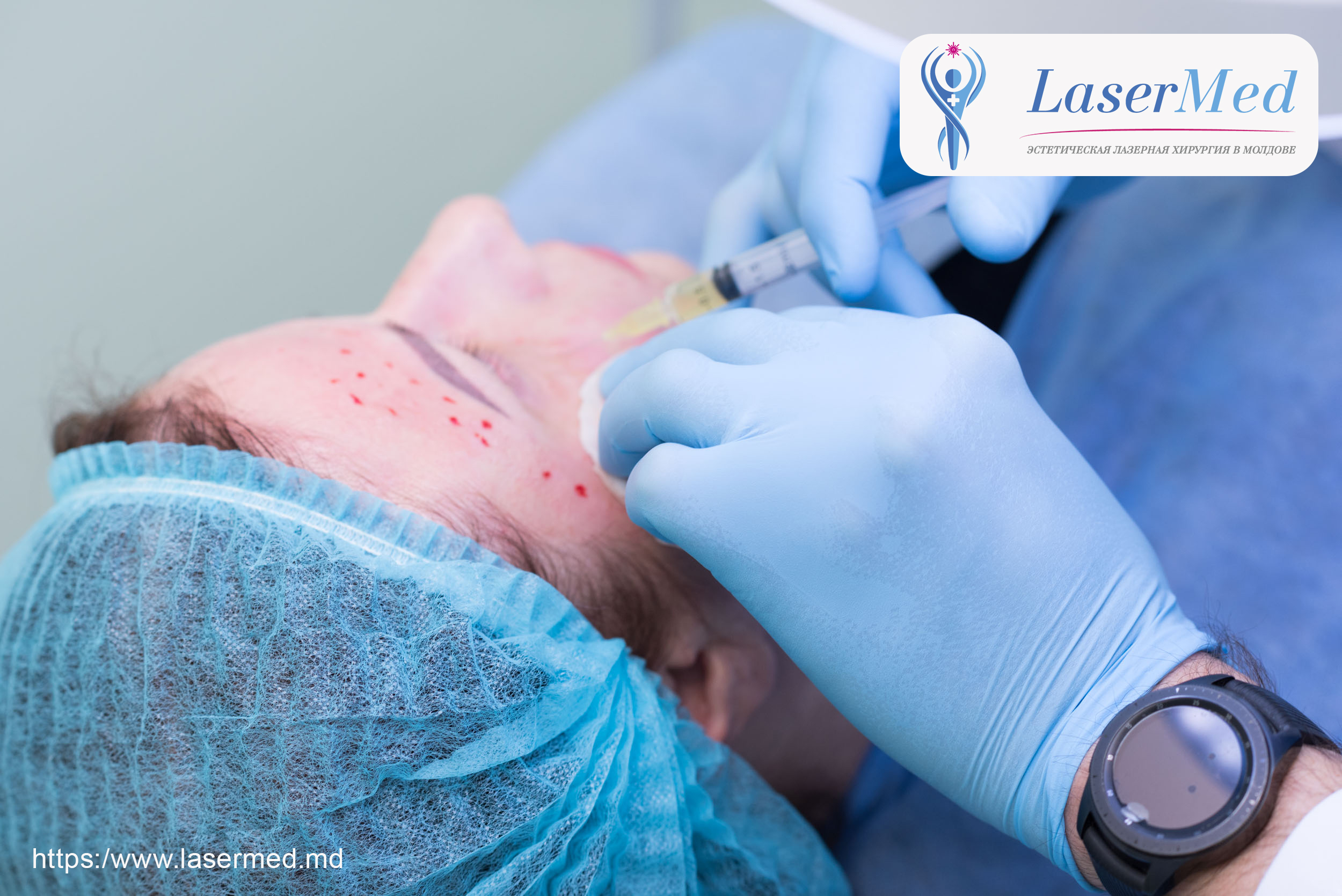 Tratament cu laser a acneei si sechelelor postacne