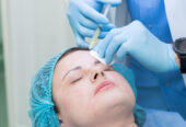 Tratament cu laser a acneei si sechelelor postacne