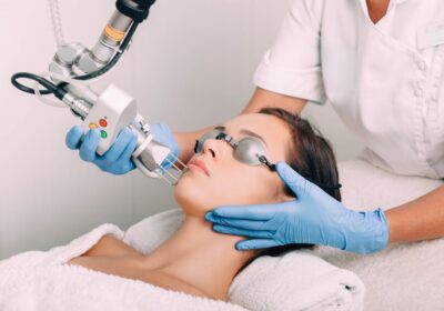 Tratament-cu-laser-pentru-inlaturarea-indepartarea-si-eliminarea-a-petelor-pigmentare-LaserMedMoldova