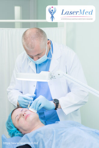 Tratament cu laser a acneei si sechelelor postacne