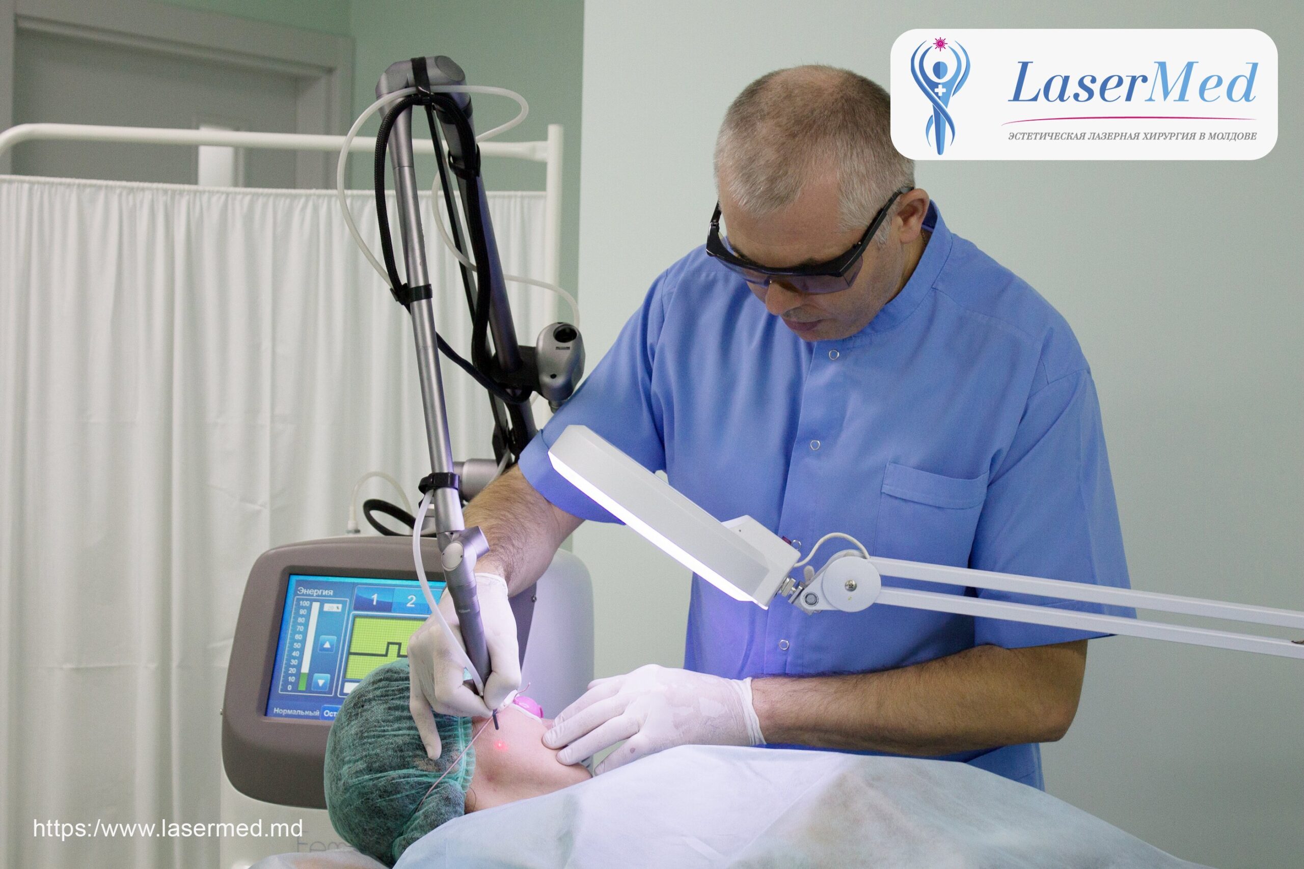 Лазерное удаление родинок невусов молдова