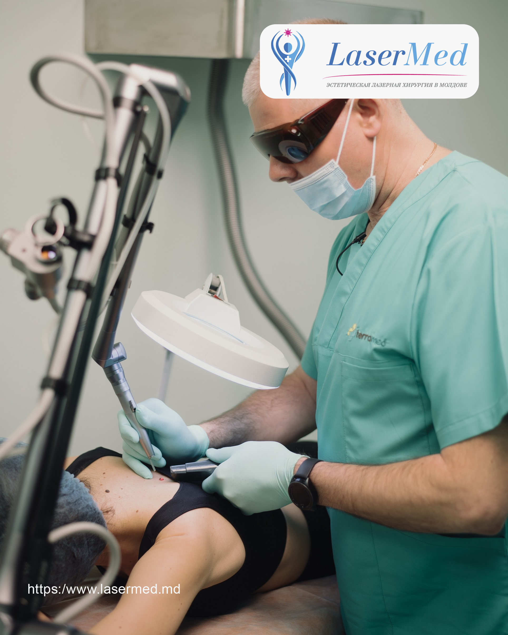 Eliminarea alunitelor (nevilor) cu laser