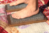Acupunctura. Placa Sadhu.