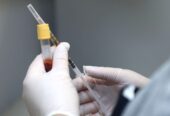 PRP terapie (Platelet Rich Plasma) in Moldova