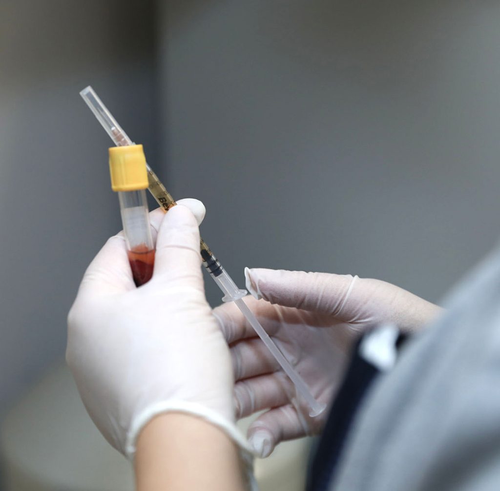 PRP terapie (Platelet Rich Plasma) in Moldova