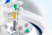PRP terapie (Platelet Rich Plasma) in Moldova