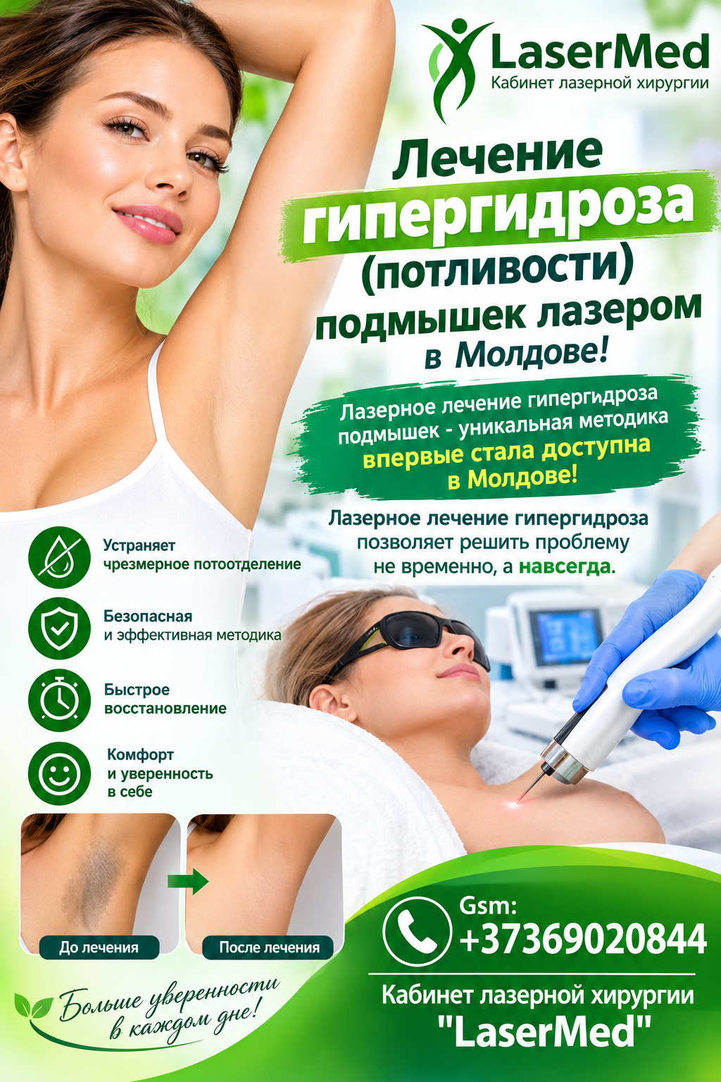  ‘’Tratamentul cu laser a hiperhidrozei axilare in