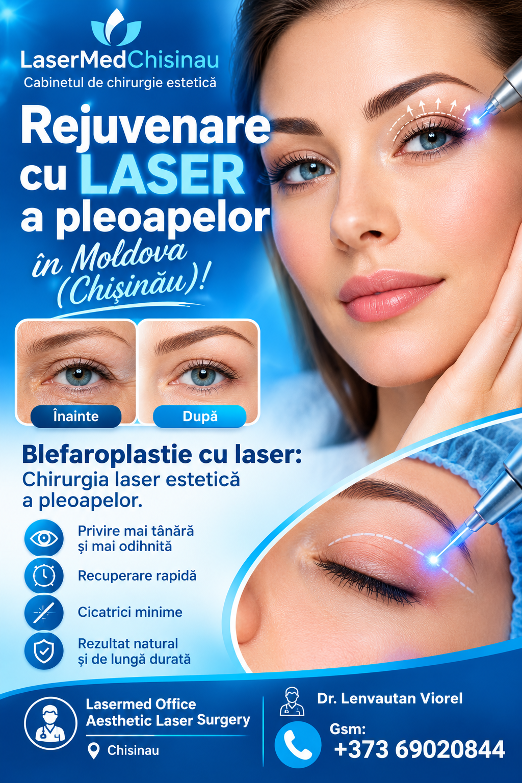 Rejuvenare cu  laser a pleoapelor in Moldova (Chis