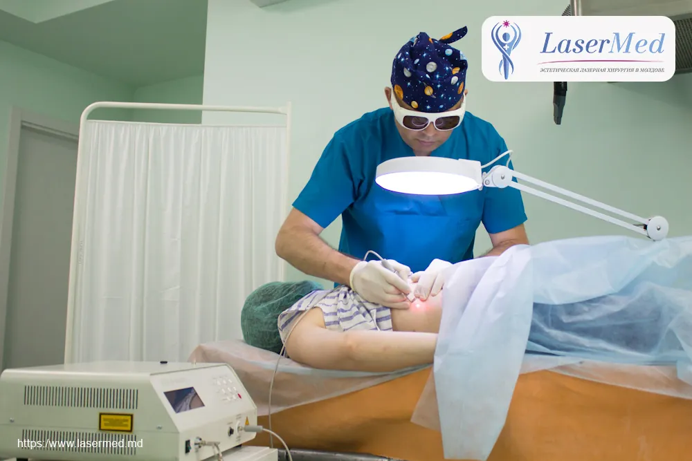 Лазерное удаление  новообразований в Молдове!